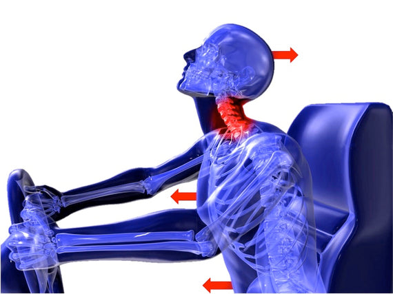 The Role of Biomechanics in Motor Vehicle Accident Litigation